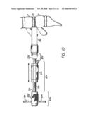 Distractor for use in spinal surgery and method of use thereof diagram and image