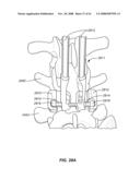 MEASUREMENT AND TRIALING SYSTEM AND METHODS FOR ORTHOPEDIC DEVICE COMPONENT SELECTION diagram and image