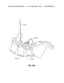 MEASUREMENT AND TRIALING SYSTEM AND METHODS FOR ORTHOPEDIC DEVICE COMPONENT SELECTION diagram and image