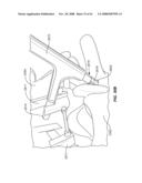 MEASUREMENT AND TRIALING SYSTEM AND METHODS FOR ORTHOPEDIC DEVICE COMPONENT SELECTION diagram and image