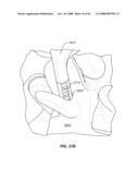 MEASUREMENT AND TRIALING SYSTEM AND METHODS FOR ORTHOPEDIC DEVICE COMPONENT SELECTION diagram and image