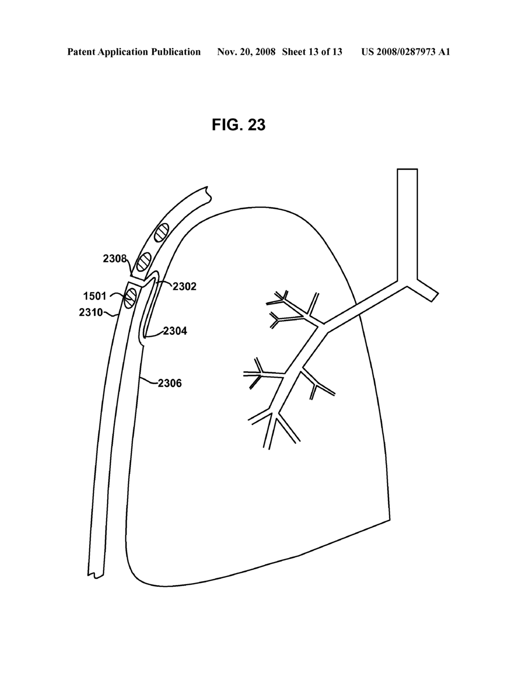 VARIABLE PARIETAL/VISCERAL PLEURAL COUPLING - diagram, schematic, and image 14