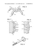 Tissue holding implants diagram and image