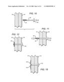 Tissue holding implants diagram and image