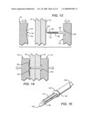 Tissue holding implants diagram and image