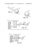 Tissue holding implants diagram and image