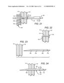 Tissue holding implants diagram and image