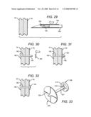 Tissue holding implants diagram and image