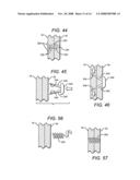 Tissue holding implants diagram and image