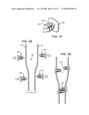 Tissue holding implants diagram and image