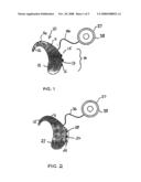 Hearing System Prostheses diagram and image