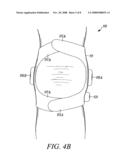 Stimulation Device for Treating Osteoarthritis diagram and image