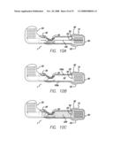 Flexible Circuit Electrode Array with Wire or Film Support diagram and image