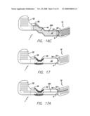 Flexible Circuit Electrode Array with Wire or Film Support diagram and image