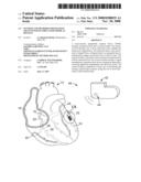 SYSTEMS AND METHODS FOR FIXATING TRANSVENOUSLY IMPLANTED MEDICAL DEVICES diagram and image