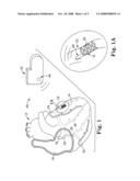 SYSTEMS AND METHODS FOR FIXATING TRANSVENOUSLY IMPLANTED MEDICAL DEVICES diagram and image