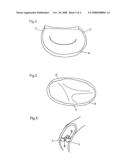 DEVICE FOR SHRINKING OR REINFORCING THE VALVULAR ORIFICES OF THE HEART diagram and image