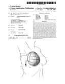 Methods and Devices for Breast Reconstruction diagram and image