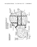 Methods and Devices for Breast Reconstruction diagram and image