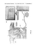 Methods and Devices for Breast Reconstruction diagram and image