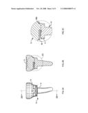 Radial Head Implant and Related Instrument diagram and image