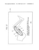 Robot for training a rehabilitator diagram and image