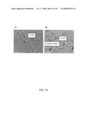 DIFFUSION-HARDENED MEDICAL IMPLANT diagram and image