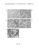 DIFFUSION-HARDENED MEDICAL IMPLANT diagram and image