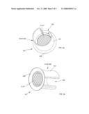 DEVICE FOR SUPPLYING A HYDRAULIC BRAKE CIRCUIT COMPRISING A PARTICLE FILTER diagram and image