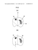 Diagnostic Imaging Support System and Diagnostic Imaging Support Program diagram and image