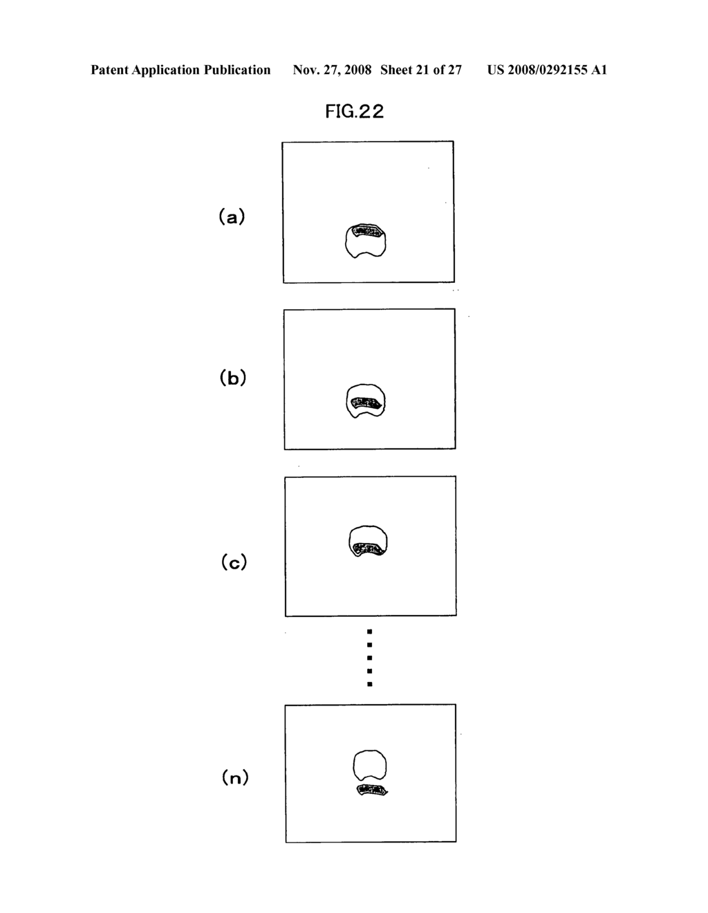 Diagnostic Imaging Support System and Diagnostic Imaging Support Program - diagram, schematic, and image 22