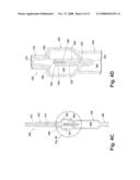 SYSTEMS AND METHODS FOR TREATING HOLLOW ANATOMICAL STRUCTURES diagram and image