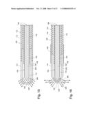 SYSTEMS AND METHODS FOR TREATING HOLLOW ANATOMICAL STRUCTURES diagram and image