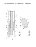 SYSTEMS AND METHODS FOR TREATING HOLLOW ANATOMICAL STRUCTURES diagram and image