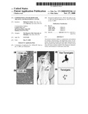 COMPOSITIONS AND METHODS FOR TREATING AND DIAGNOSING CANCER diagram and image