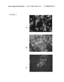 COMPOSITIONS AND METHODS FOR TREATING AND DIAGNOSING CANCER diagram and image