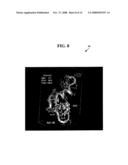 COMPOUNDS, COMPOSITIONS AND METHODS FOR MEDICAL IMAGING OF PARKINSON S DISEASE diagram and image