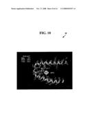 COMPOUNDS, COMPOSITIONS AND METHODS FOR MEDICAL IMAGING OF PARKINSON S DISEASE diagram and image