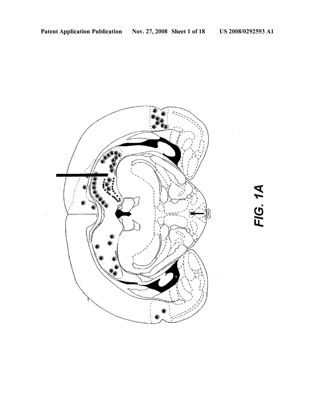 GENE THERAPY FOR SPINAL CORD DISORDERS - diagram, schematic, and image 02