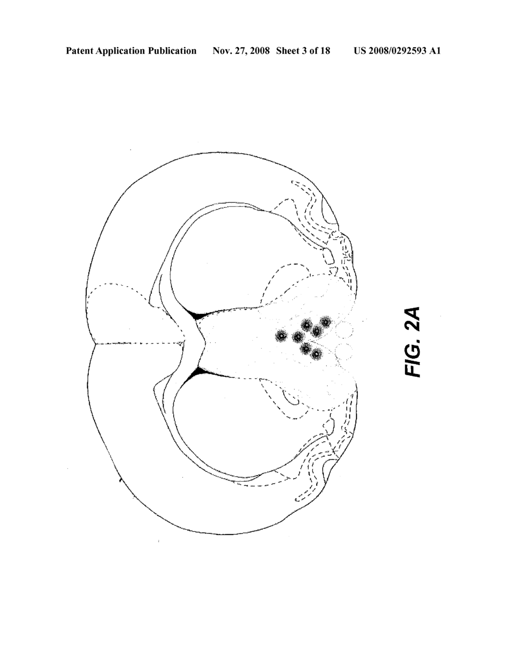 GENE THERAPY FOR SPINAL CORD DISORDERS - diagram, schematic, and image 04