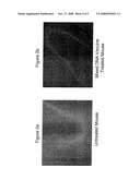 TREATMENT AND PREVENTION OF NEURODEGENERATIVE DISEASES USING GENE THERAPY diagram and image