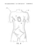 Ultrasound Training Mannequin diagram and image
