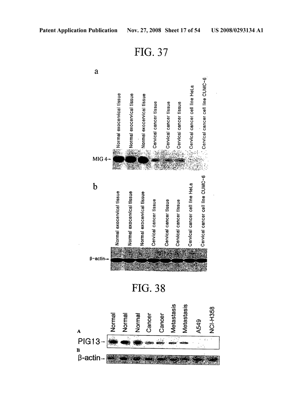 Human Cancer Suppressor Gene, Protein Encoded Therein, Expression Vector Containing Same - diagram, schematic, and image 18