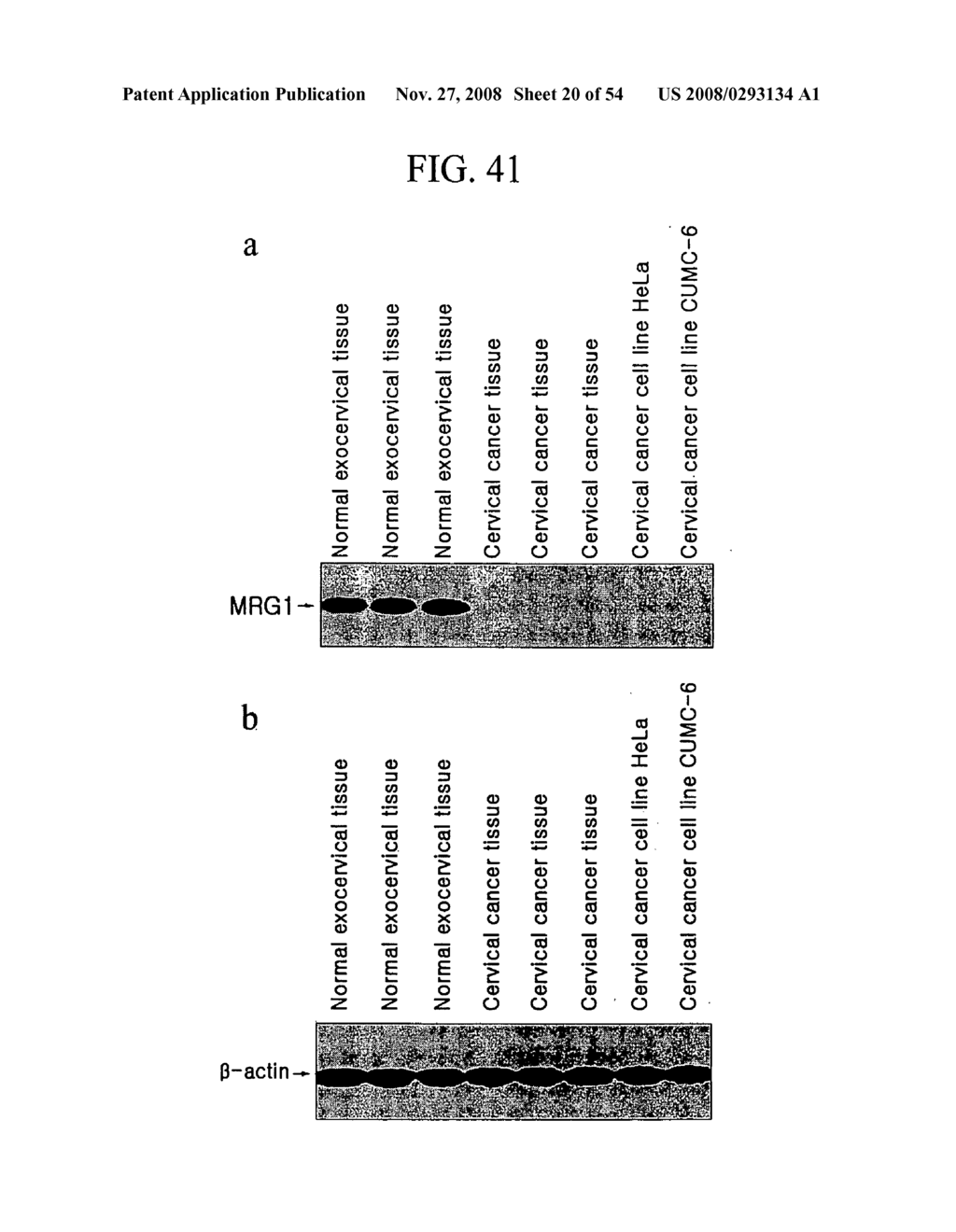 Human Cancer Suppressor Gene, Protein Encoded Therein, Expression Vector Containing Same - diagram, schematic, and image 21