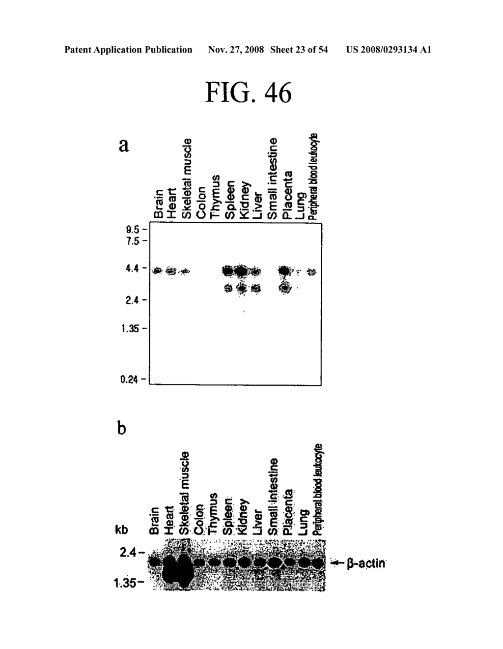 Human Cancer Suppressor Gene, Protein Encoded Therein, Expression Vector Containing Same - diagram, schematic, and image 24