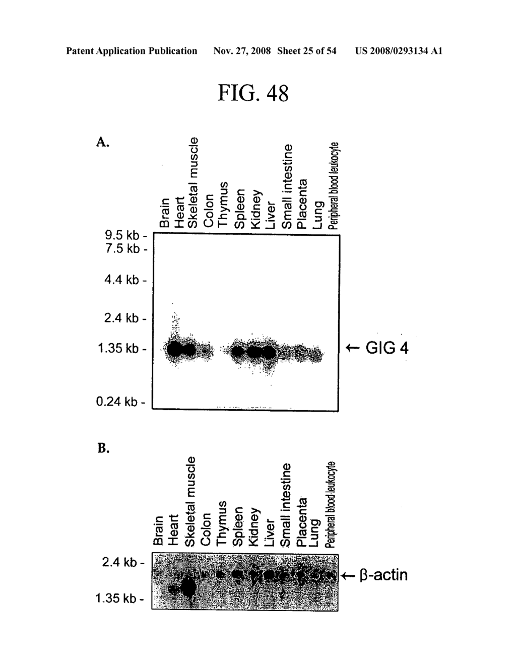 Human Cancer Suppressor Gene, Protein Encoded Therein, Expression Vector Containing Same - diagram, schematic, and image 26