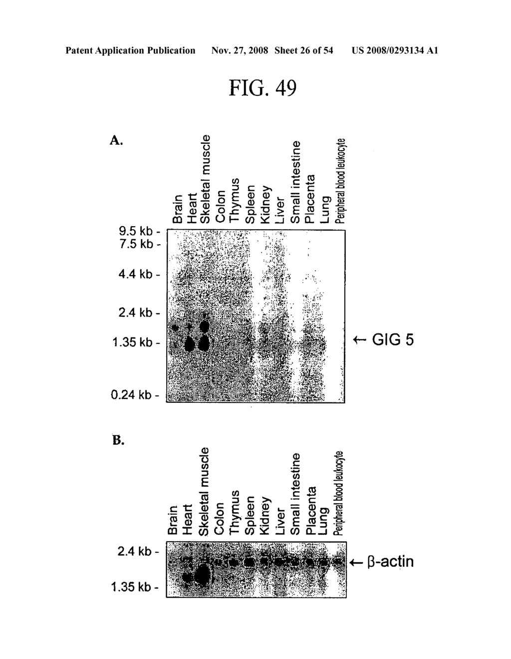 Human Cancer Suppressor Gene, Protein Encoded Therein, Expression Vector Containing Same - diagram, schematic, and image 27