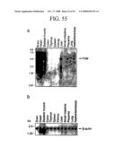 Human Cancer Suppressor Gene, Protein Encoded Therein, Expression Vector Containing Same diagram and image