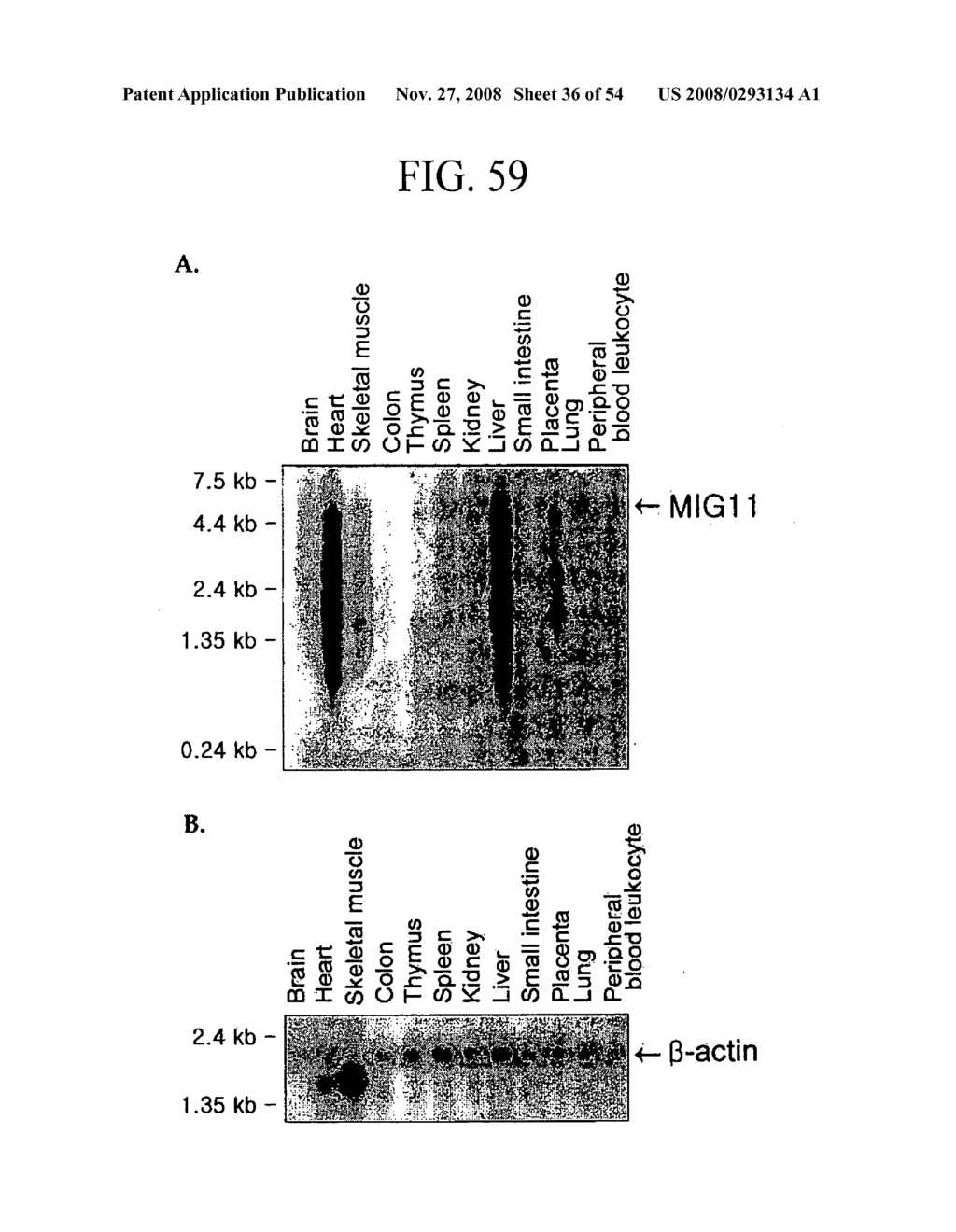 Human Cancer Suppressor Gene, Protein Encoded Therein, Expression Vector Containing Same - diagram, schematic, and image 37