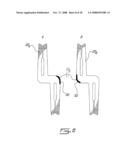 BALANCED INTERCONNECTOR diagram and image